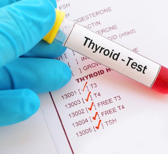 full-thyroid-blood-test-t4-and-t3-blood-test-anna-pharmacy