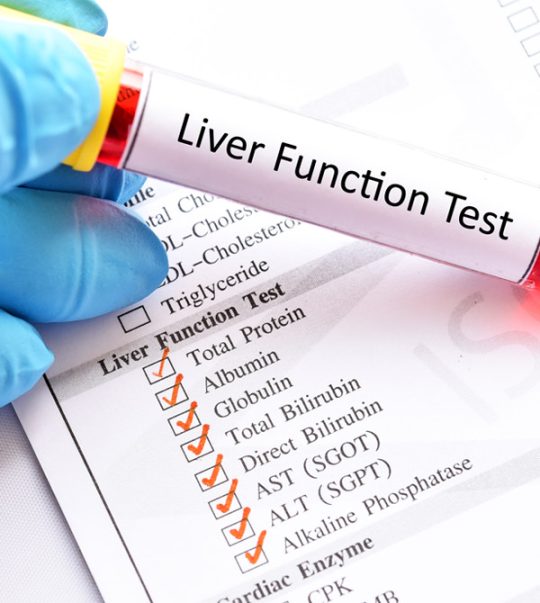 liver function blood test alp, alt, ast & ggt blood test Anna Pharmacy