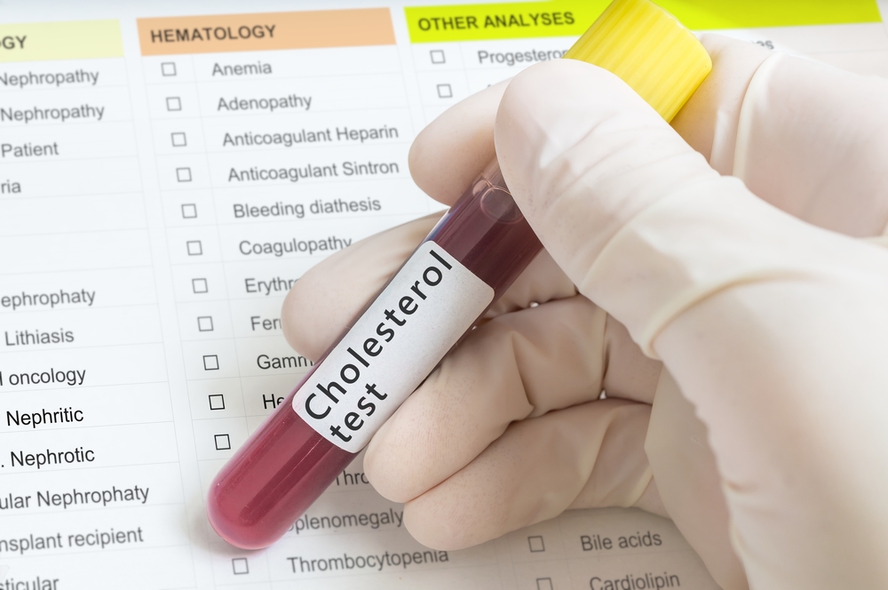 why-do-we-need-regular-cholesterol-blood-tests