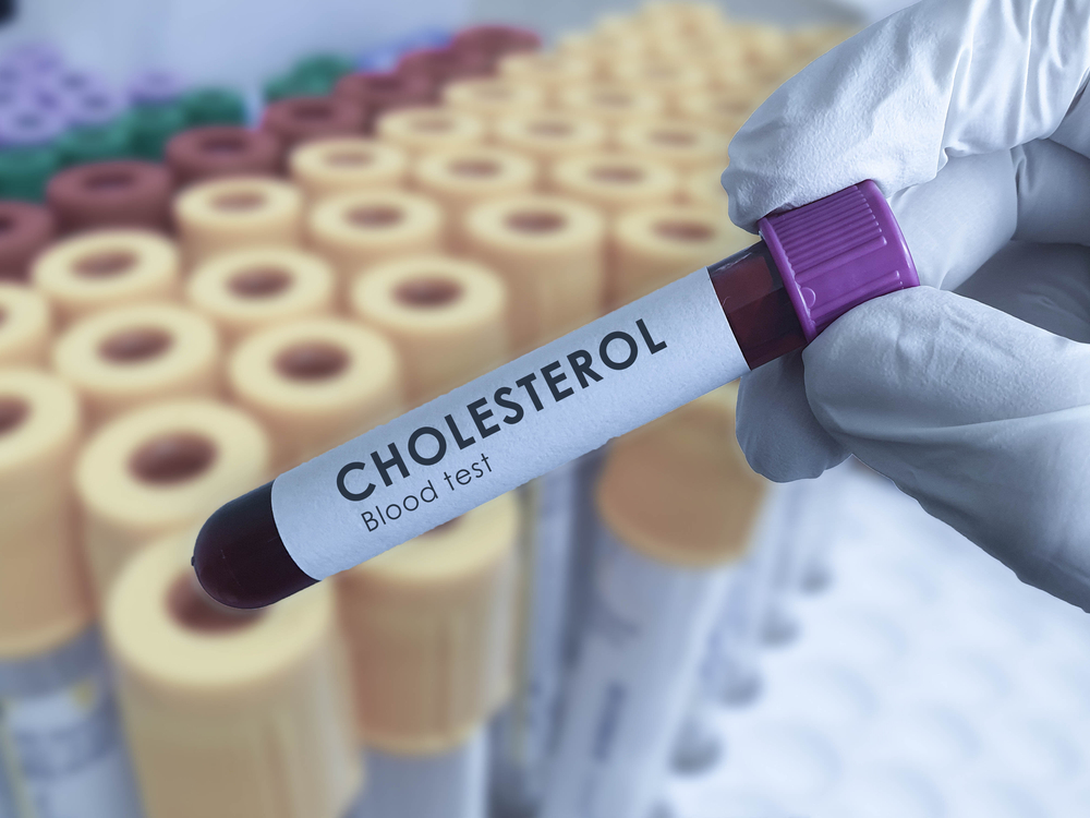 why-is-fasting-needed-before-cholesterol-blood-tests